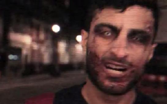 Suarez zombie? YES!