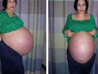 Woman who gave birth … 11 children!!!