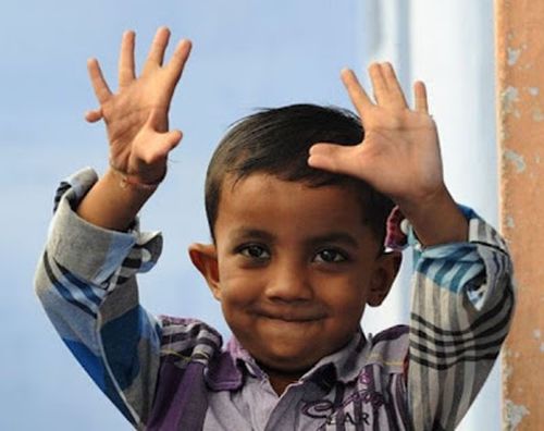 SEE the child with 25 fingers!