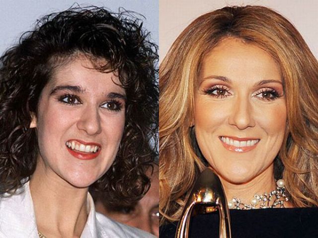 Τα χαμόγελα των celebrities πριν και μετά την επίσκεψη στον οδοντίατρο 