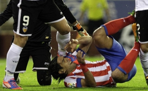 Καρέ-καρέ ο τραυματισμός του «τίγρη» Falcao! (photo+video)