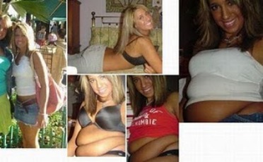 Σοκαριστικές φωτογραφίες με γυναίκες πριν και μετά το junk food!