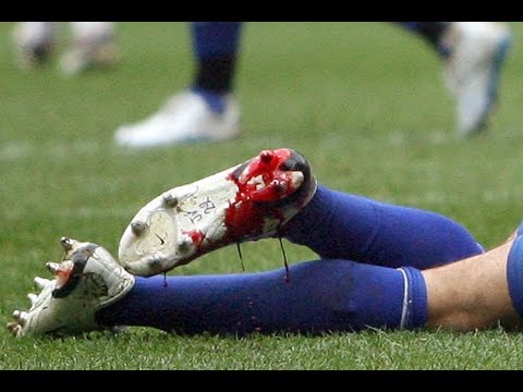 10 Most Horrific Football Injuries (18+)