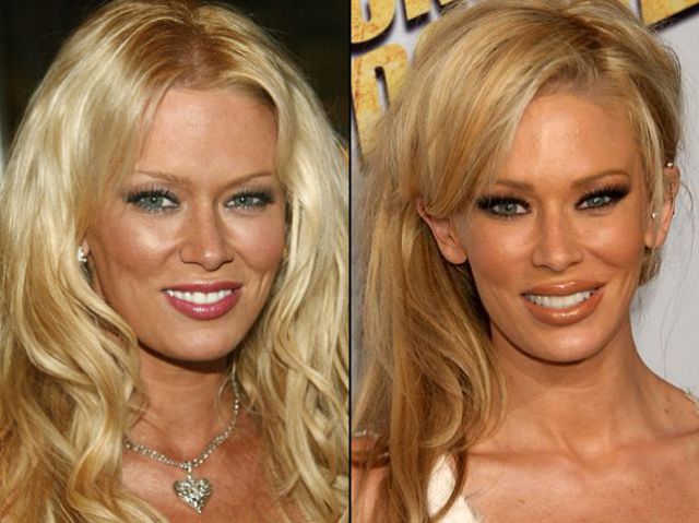 Celebrities πριν και μετά το νυστέρι!