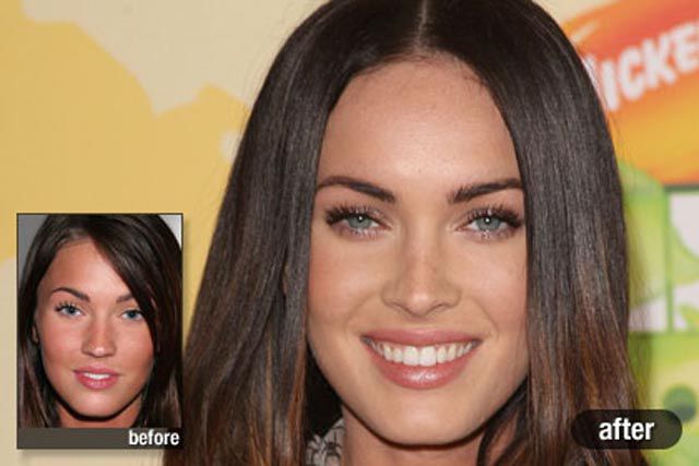 Celebrities πριν και μετά την πλαστική!