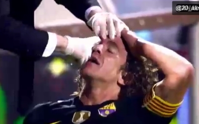 No pain, no glory for Puyol!