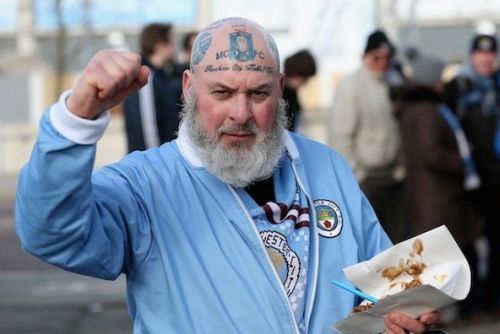 Manchester City supporter has club tattoos on his head [pics]