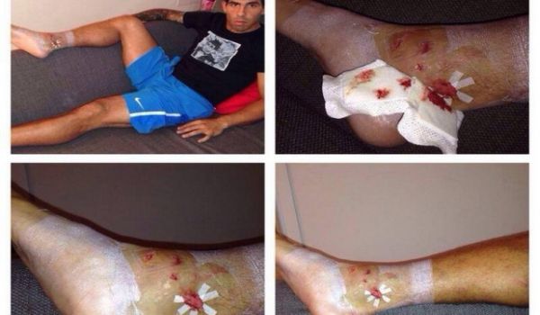 Σοκαριστικές εικόνες από τον τραυματισμό του Τέβες