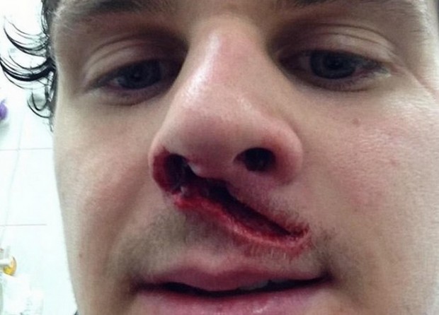 Σοκ: Απίστευτος τραυματισμός πάικτη στο χόκεϊ!