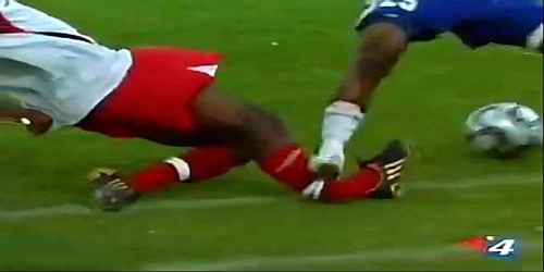 TOP 5: The worst football injuries (VIDEO)