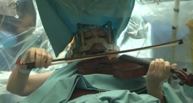 ΑΔΙΑΝΟΗΤΟ: Τη χειρουργούσαν ενώ αυτή έπαιζε βιολί (video)